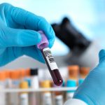 multi-cancer-blood-test-shows-real-promise-in-study