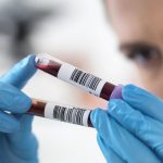 blood-test-shows-if-organs-are-ageing-fast-or-slowly