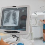 kasama-hospital-gets-x-ray-machine
